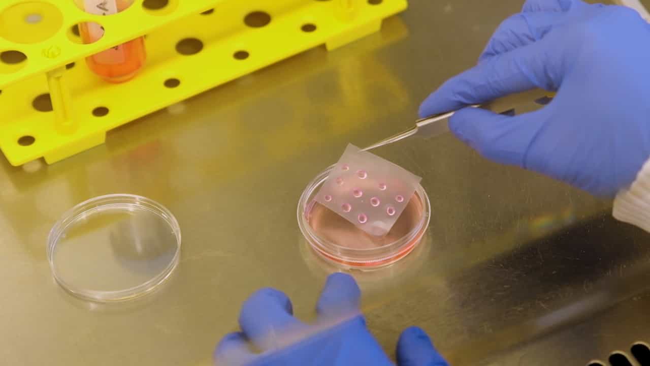 Author Spotlight: Targeted Microinjection and Electroporation of Primate Cerebral Organoids for Genetic Modification