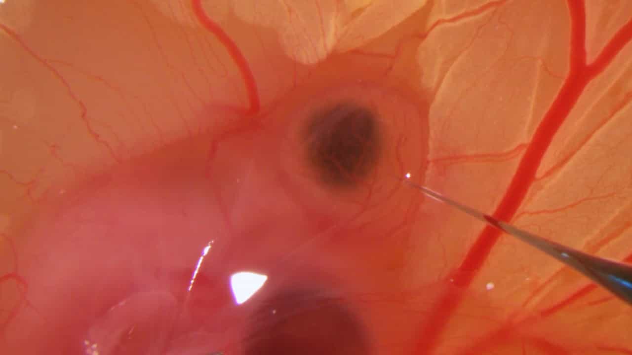 Using the Chick Embryo Brain as a Model for In Vivo and Ex Vivo Analyses of Human Glioblastoma Cell Behavior