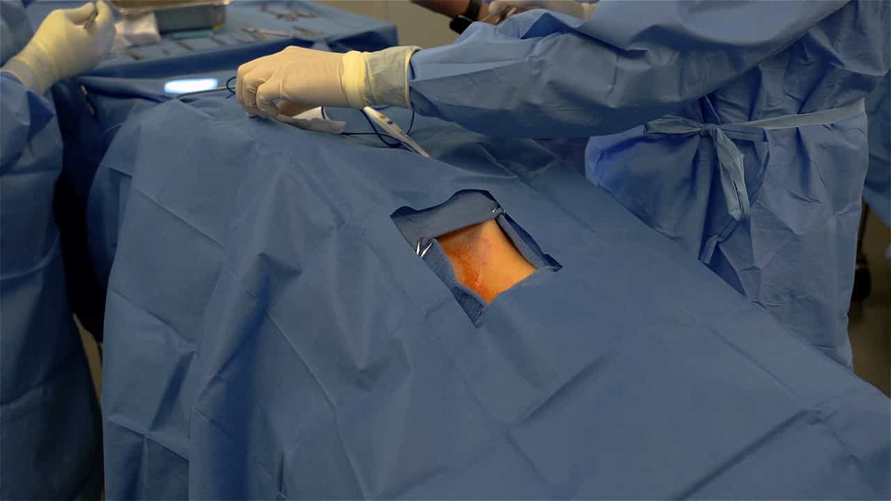 Author Spotlight: Hickman Catheter Use for Long-Term Vascular Access in a Preclinical Swine Model