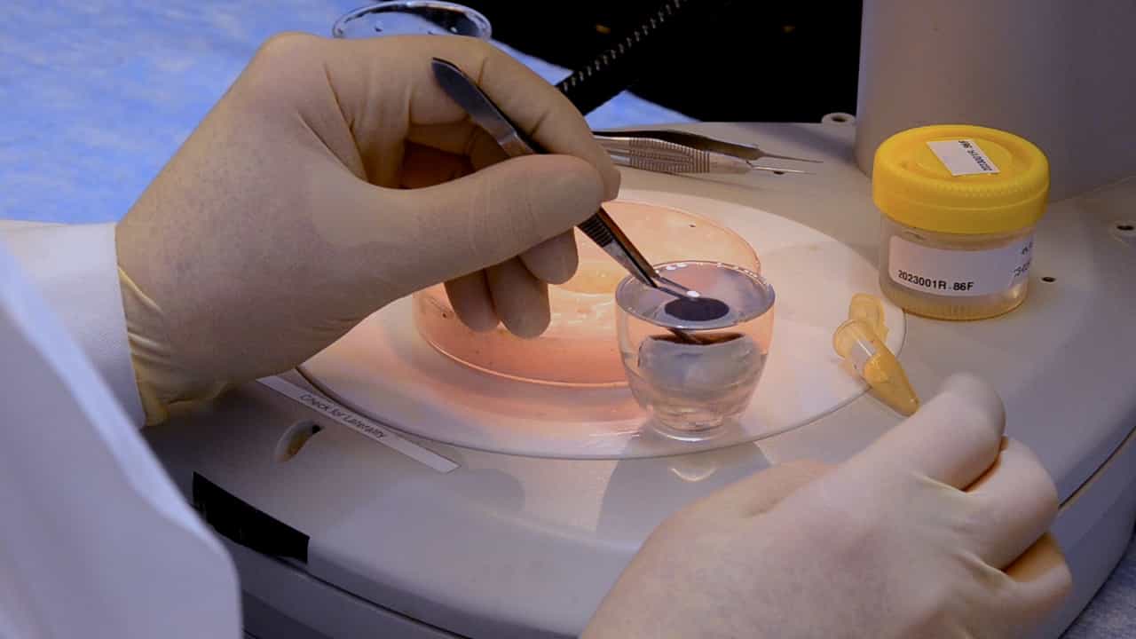 Author Spotlight: Ex Vivo OCT-Based Multimodal Imaging of Human Donor Eyes for Research into Age-Related Macular Degeneration
