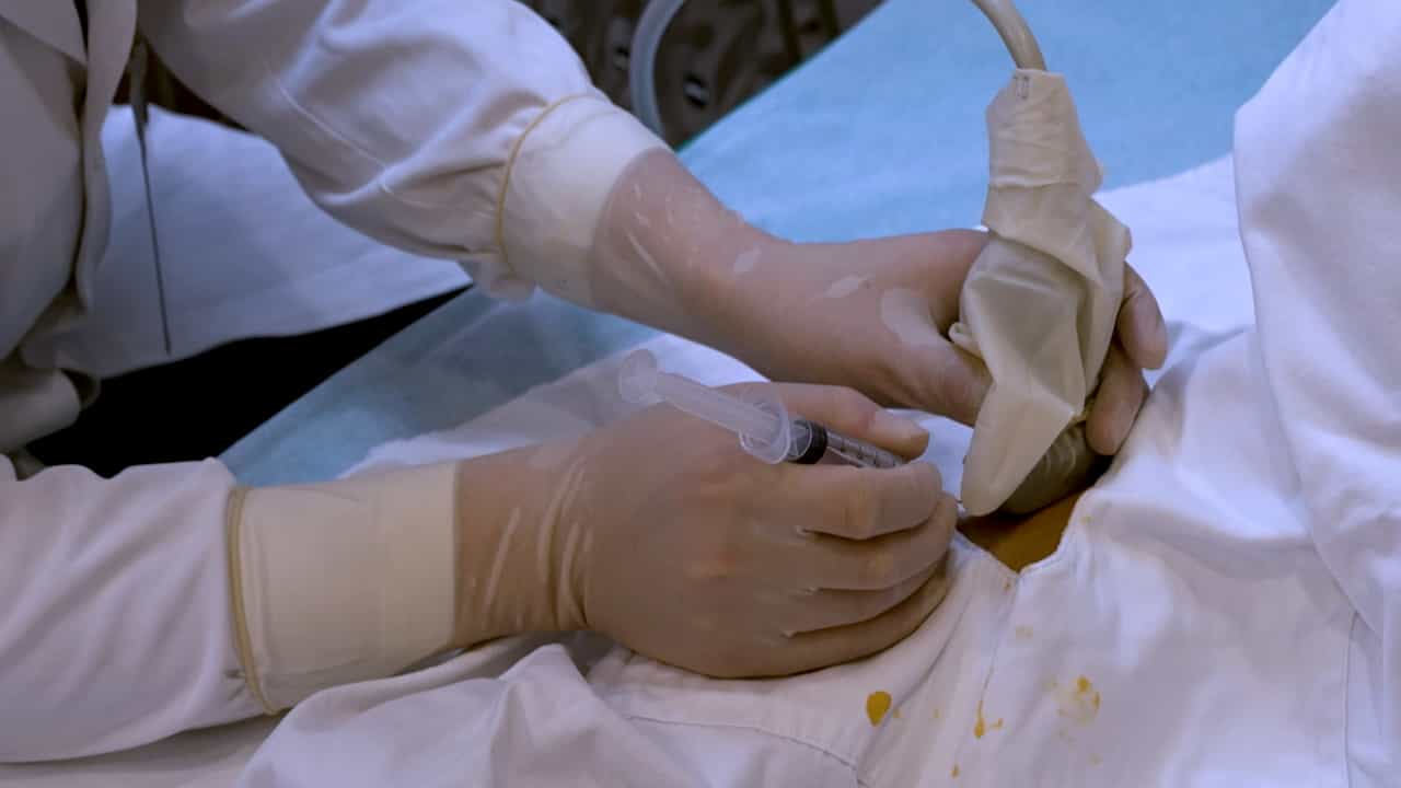 Author Spotlight: Ultrasound-Guided Needle Release Combined with Corticosteroid Injection for the Treatment of Supinator Syndrome