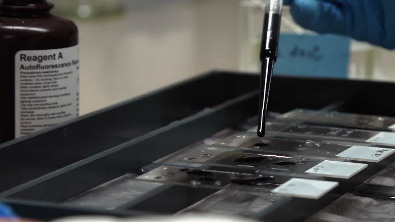 Author Spotlight: Neutrophil Extracellular Traps Imaging in Human and Mouse Tissues