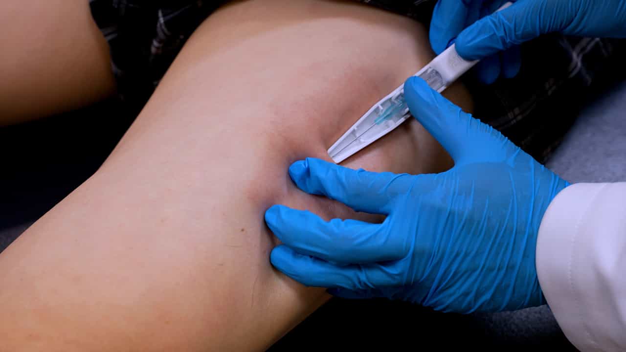 Author Spotlight: Fu's Subcutaneous Needling for Knee Osteoarthritis Pain