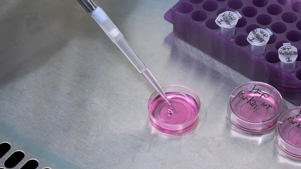 Author Spotlight: Fluorescence-Based Quantification of Mitochondrial Membrane Potential and Superoxide Levels Using Live Imaging in HeLa Cells