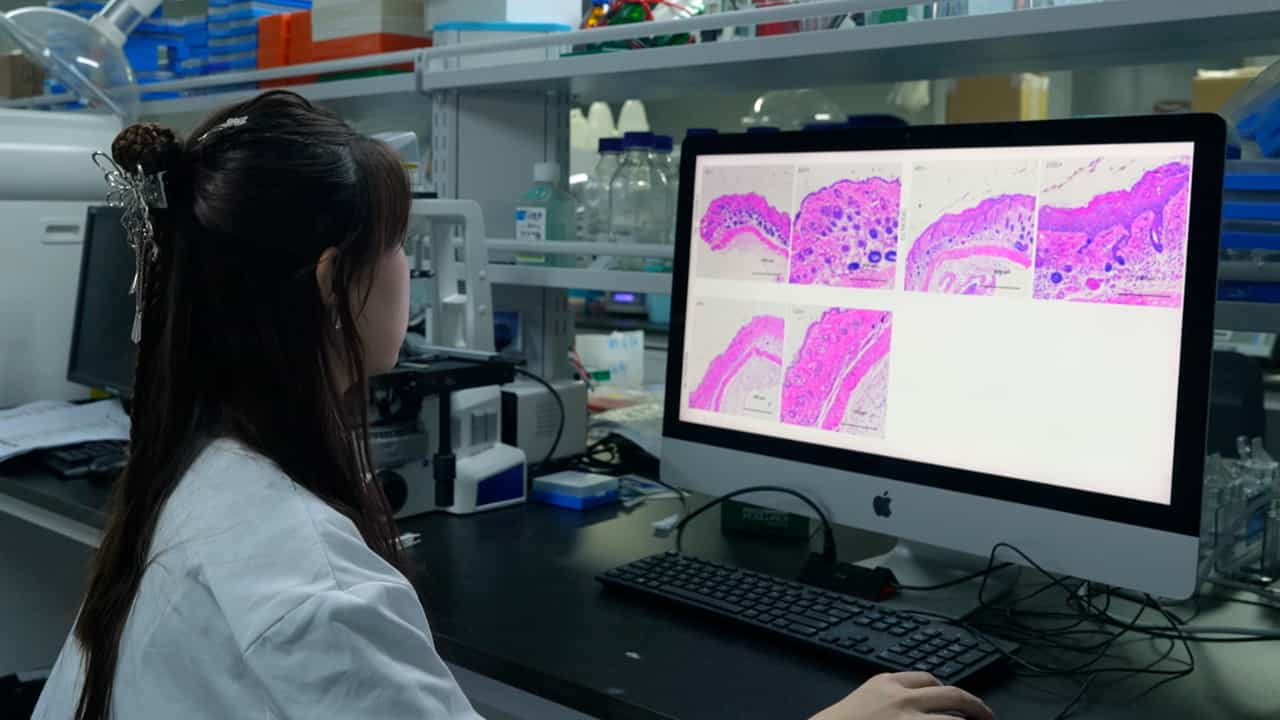 Author Spotlight: Enhancing Candida albicans Detection in Catheter Infections Using Fluorescent Protein Tagging