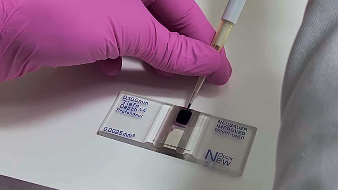 Author Spotlight: Balancing Speed, Cost, and Accuracy in Neutrophil Function Assessment with NeutroFun Screen Protocol