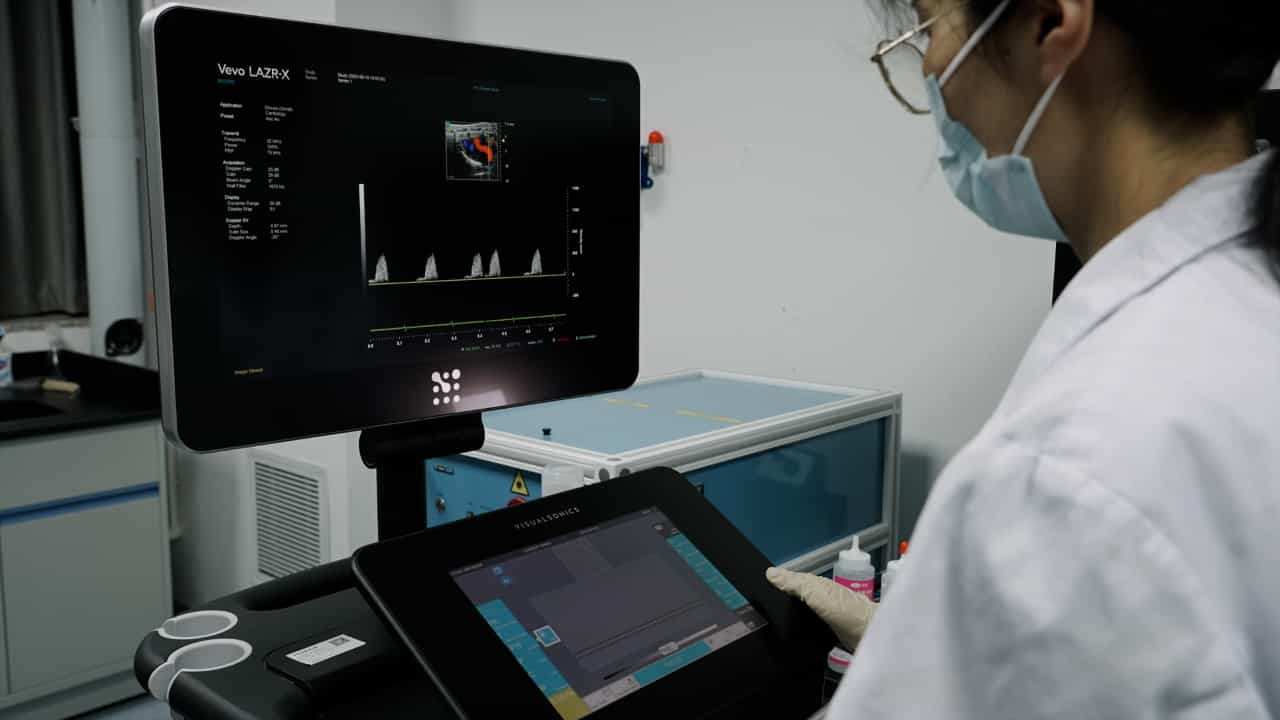 Author Spotlight: Improved Localization and Monitoring of Coronary Flow Reserve Using Modified PLAX View in Mice