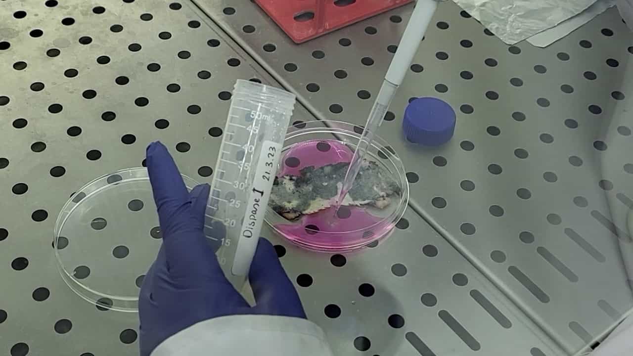 Murine Dermal Lymphatic Endothelial Cell Isolation