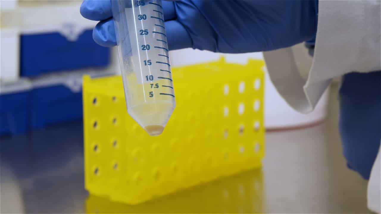 Author Spotlight: Optimizing CFU Determination for Efficient Assessment of TB Vaccine Efficacy and Antigen Presentation Analysis