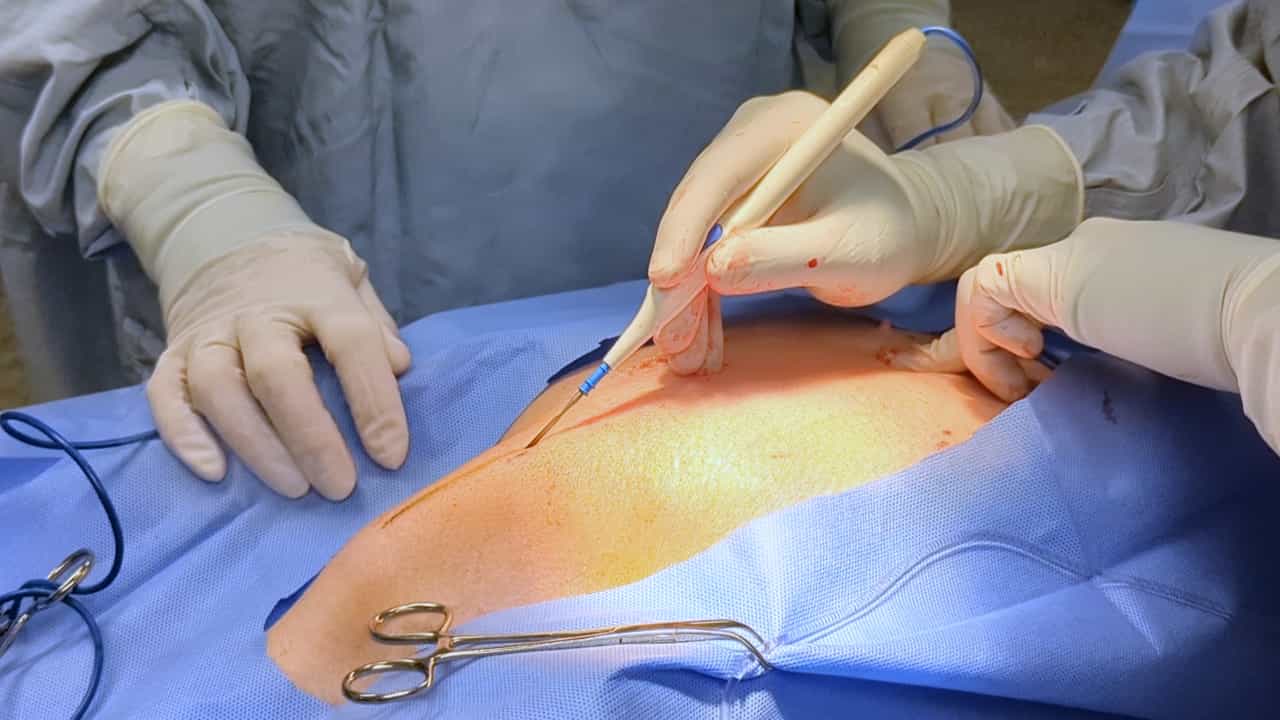 Author Spotlight: Enhancing Coronary Artery Revascularization