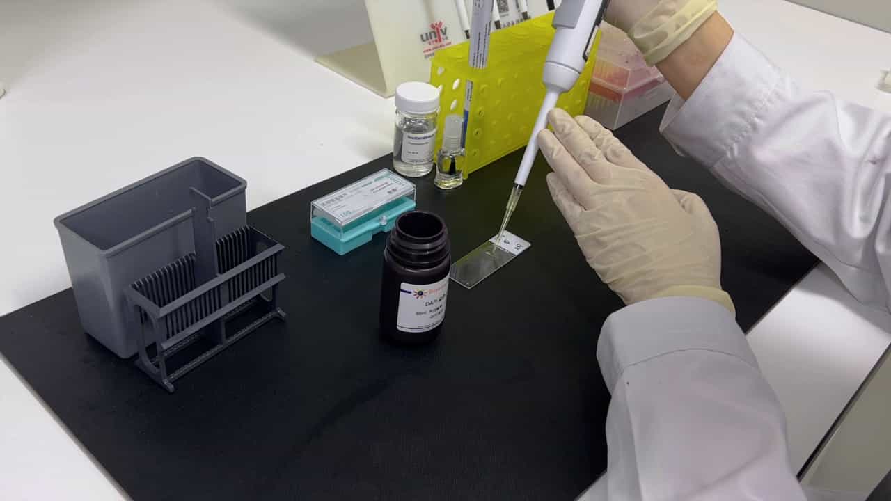 Author Spotlight: Insights and Innovations in Gene Expression Manipulation Techniques for Choroid Plexus Research