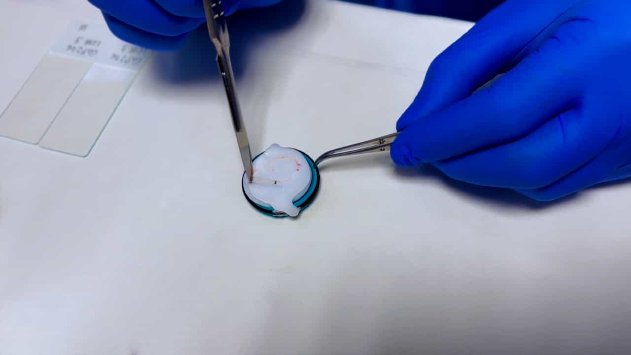 Author Spotlight: Advancing Prostate Cancer Research Through Improved Tissue Sampling and Biobanking