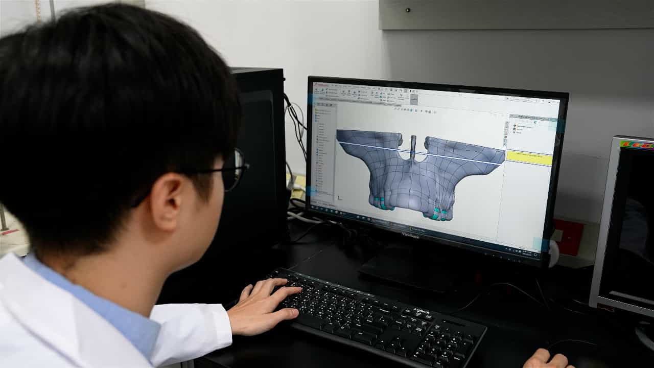 Author Spotlight: Development of a Novel Finite Element Analysis Model for Improved Orthognathic Surgical Techniques
