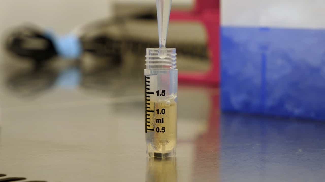 Author Spotlight: Preservation of Bioenergetic Parameters in Peripheral Blood Mononuclear Cells After Cryopreservation