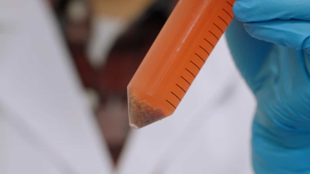 Author Spotlight: Investigating Liver Cancer Pathogenesis Using Patient-Derived Organoids