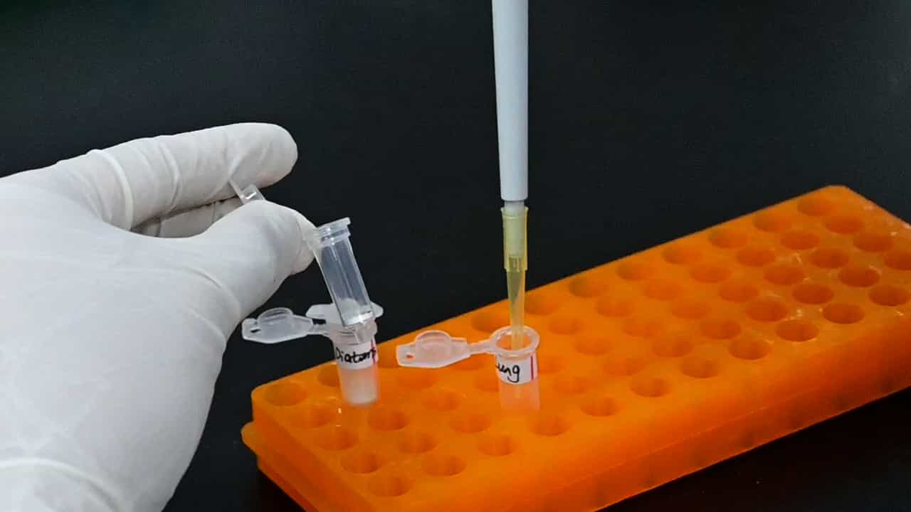 Author Spotlight: Diatom Testing for Forensic Drowning Examination