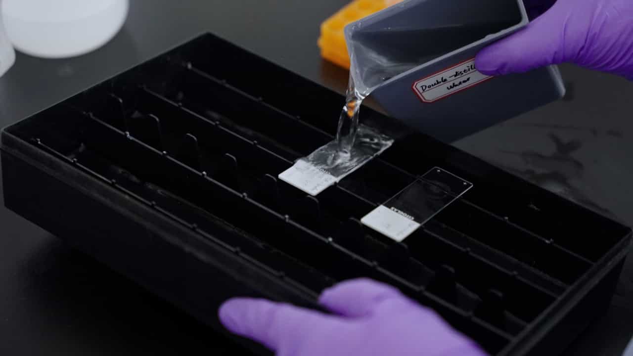 Author Spotlight: Enhancing Multicolor Fluorescence Localization in Lung Carcinoma Sample