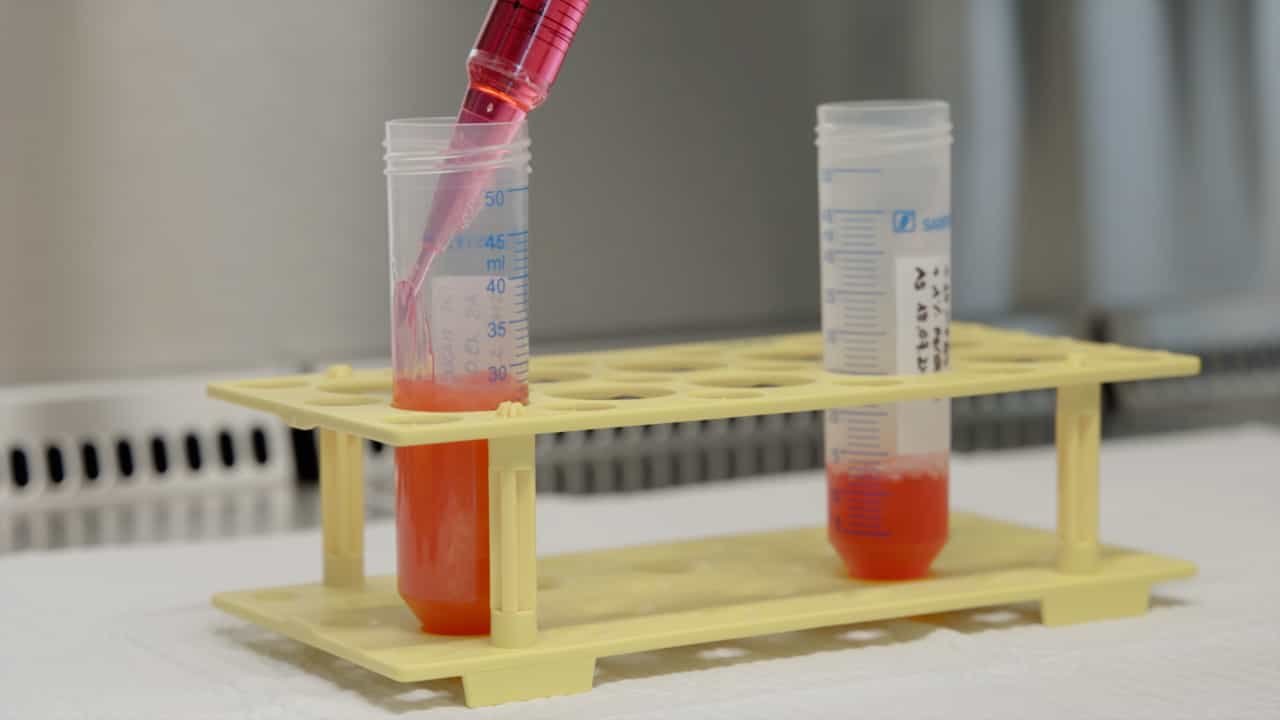 Author Spotlight: Exploring the Potential of Fat-Derived Stromal Vascular Fraction for Wound Healing