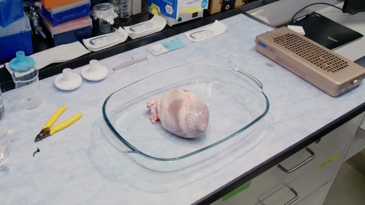 An Ex Vivo Porcine Model for Hydrodynamic Testing of Experimental Aortic Valve Procedures and Novel Medical Devices