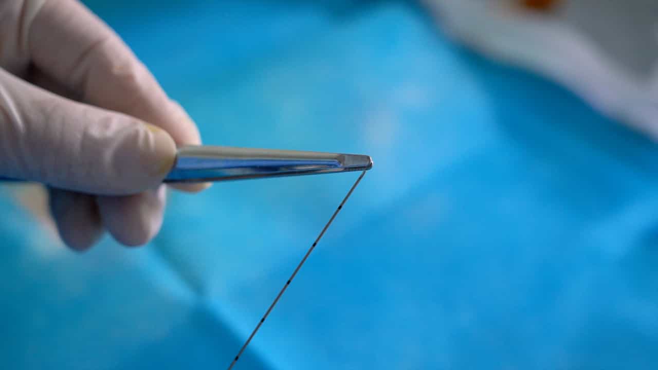 Author Spotlight: Exploring Acupuncture in Alzheimer's Research from Thread-Embedding Techniques to Clinical Trials