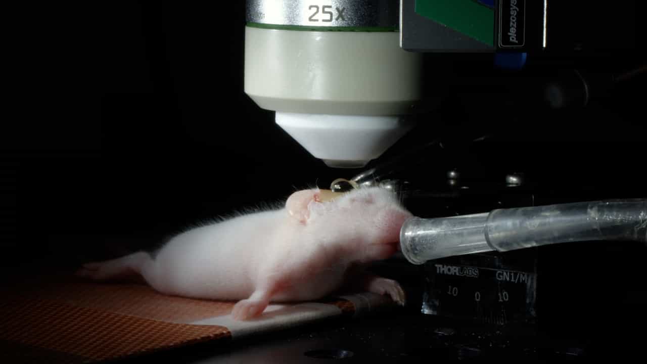 In Vivo Visualization of Spontaneous Activity in Neonatal Mouse Sensory Cortex at a Single-Neuron Resolution