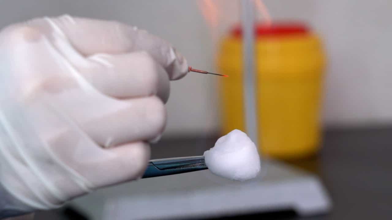 Author Spotlight: Exploring the Impact of Lingnan Fire-Needle Therapy in Osteoporosis Intervention
