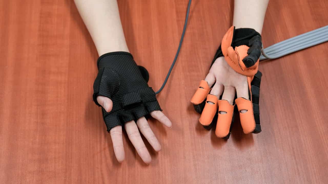 Author Spotlight: Advancing Upper Limb Rehabilitation in Patients with Right Hemisphere Damage Using Assisted Active Exercise
