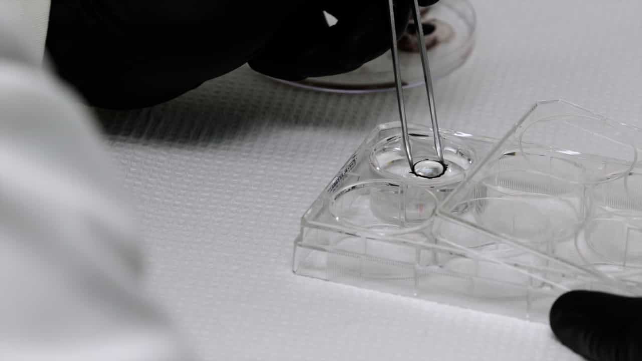 Author Spotlight: Advancing Understanding of Age-Related Lens Stiffness Changes