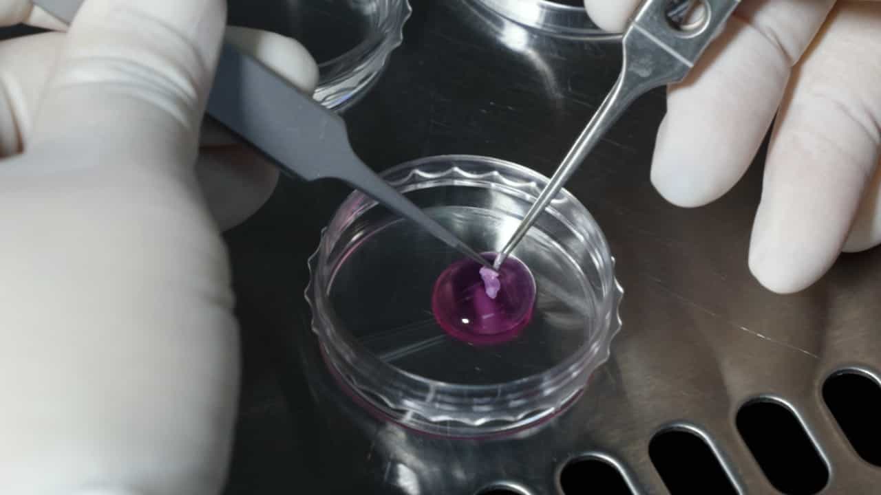 Author Spotlight: Enhanced Isolation and Characterization of Vascular Wall Resident Murine CD34+ Stem Cells Using Magnetic Bead Screening-Coupled Flow Cytometry