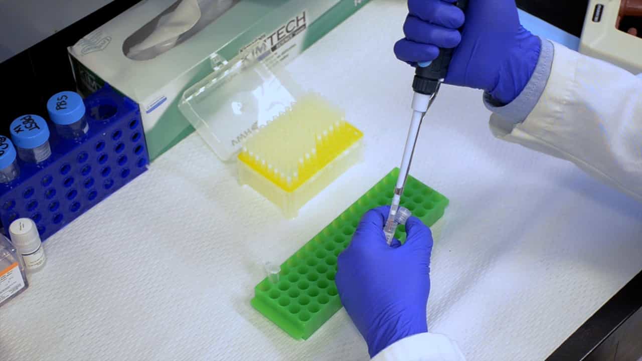 Author Spotlight: Novel Assay for Studying B-Cell Responses in Multiple Sclerosis Research