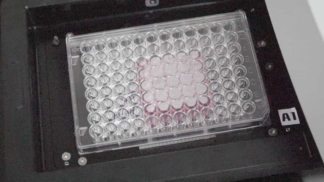 Author Spotlight: High-Throughput Measurement of Intracellular ROS Levels in Hepatocellular Lines