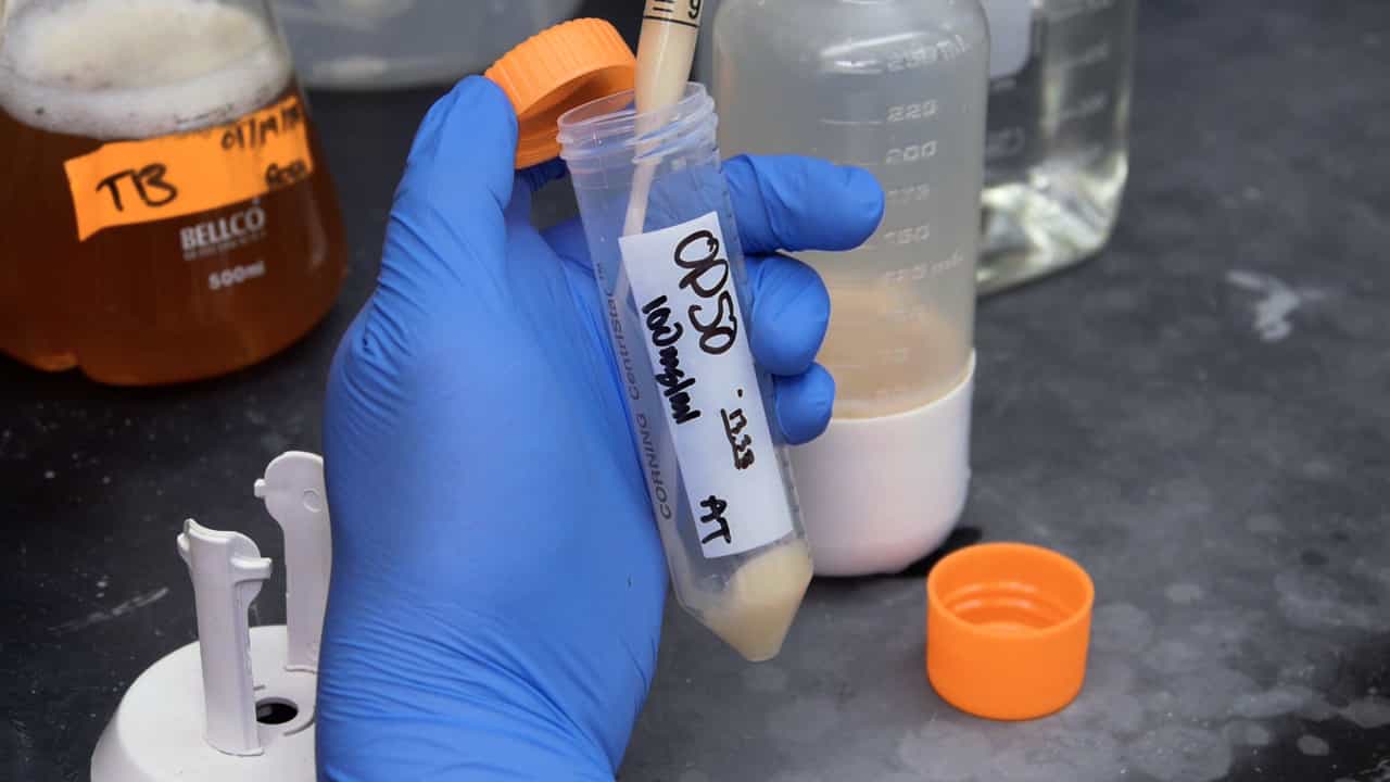 Author Spotlight: Exploring the Relationship Between Lipotoxicity and HFpEF