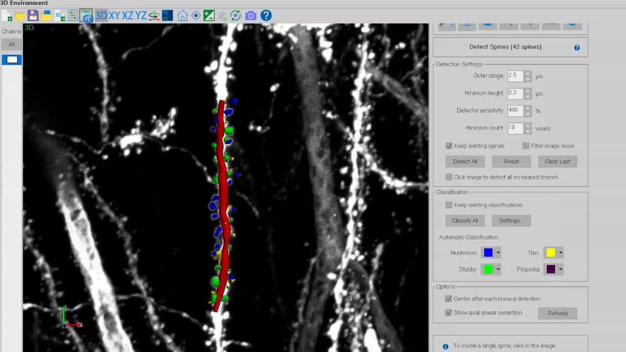 Author Spotlight: Optimizing Dendritic Spine Analysis for Balanced Manual and Automated Assessment in the Hippocampus CA1 Apical Dendrites