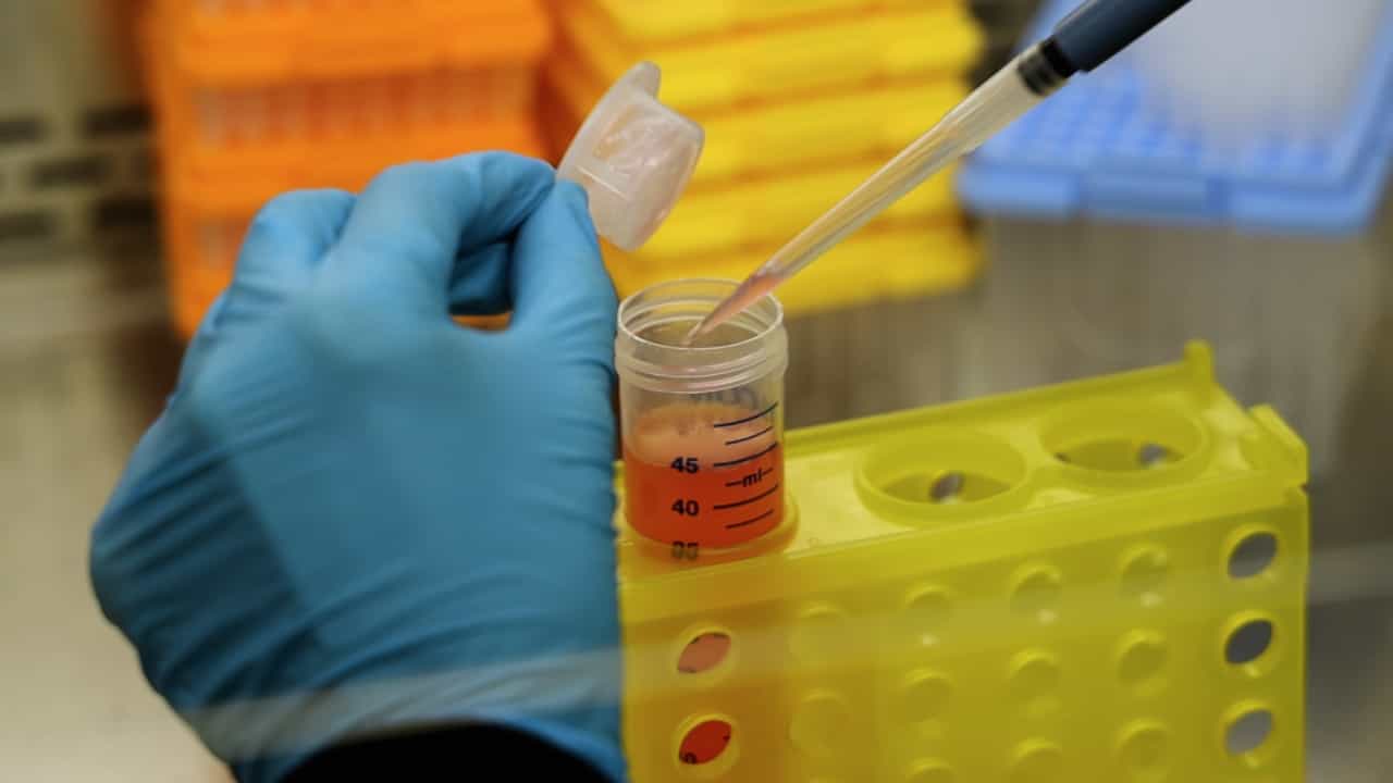 Author Spotlight: Recreating Melanoma Complexity with Patient-Derived Organoids for Immunotherapy Evaluation