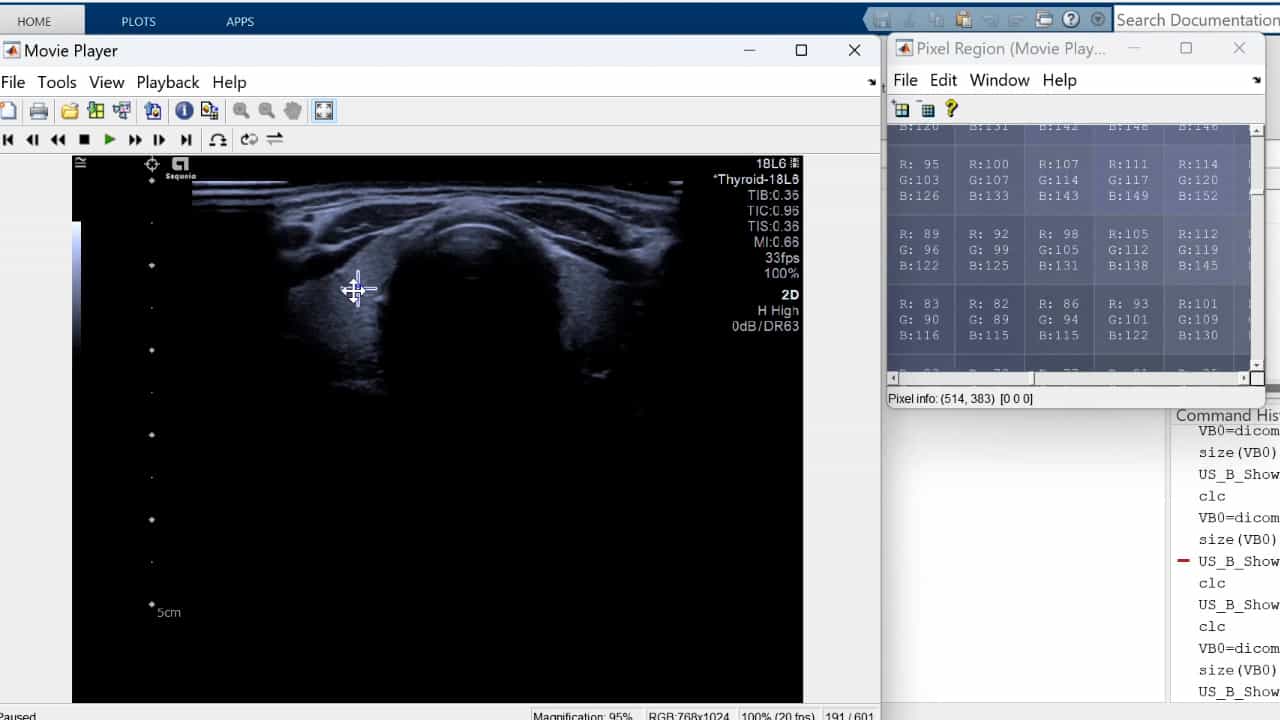 Author Spotlight: Integrating Ultrasound Imaging with Biochemical Markers for Thyroid Disease Diagnosis