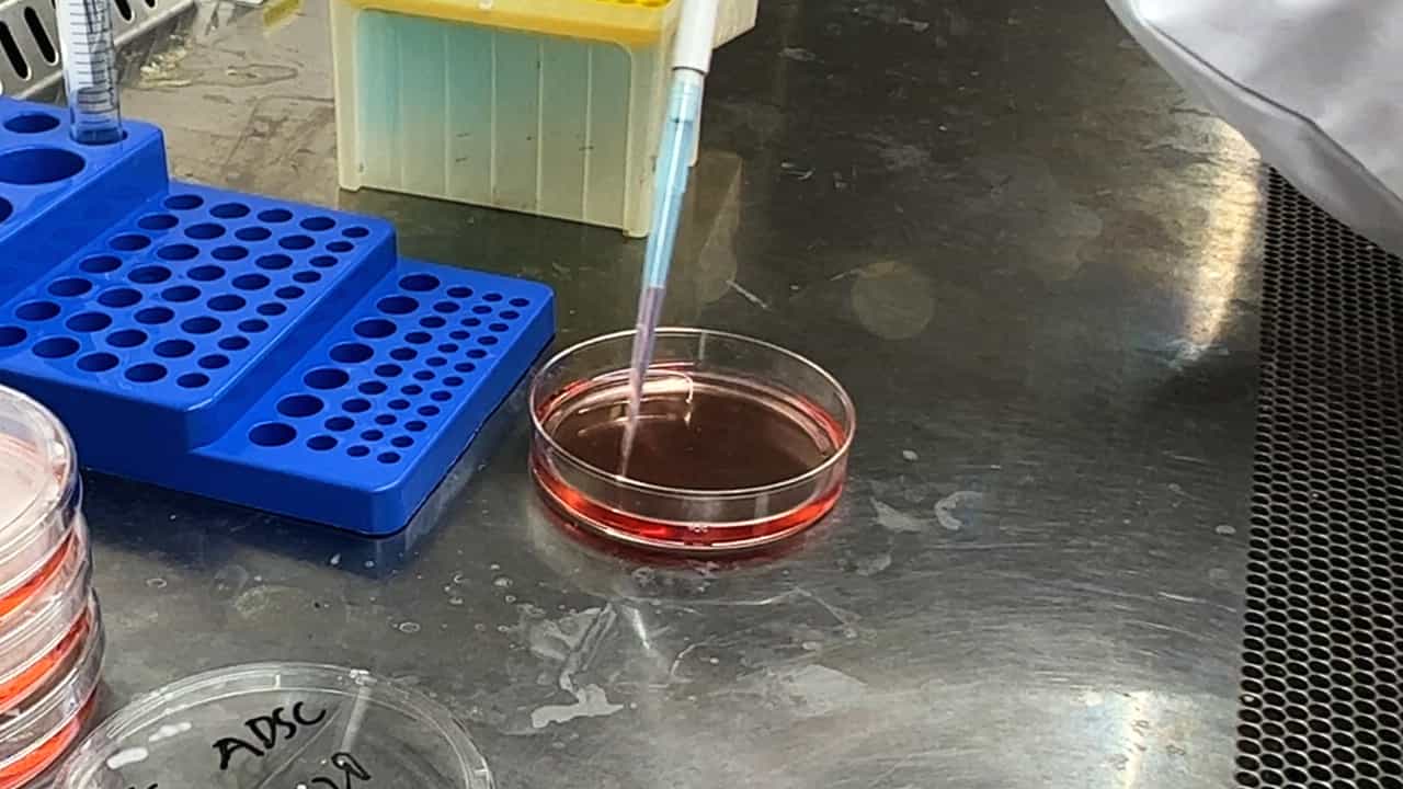 Author Spotlight: Standardizing and Improving the Extraction and Purification of Extracellular Vesicles from Human ADSCs