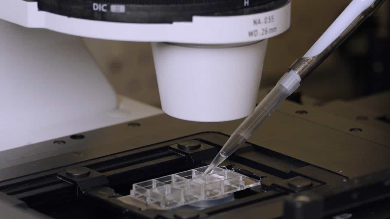 Alternative Methods for the Detection of Superoxide Anion Generation in Platelets