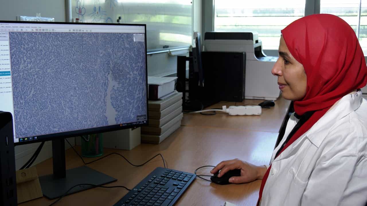 Author Spotlight: Investigating Immune Cell Dynamics in the Tumor Microenvironment — Challenges and Innovations in Cancer Prognosis