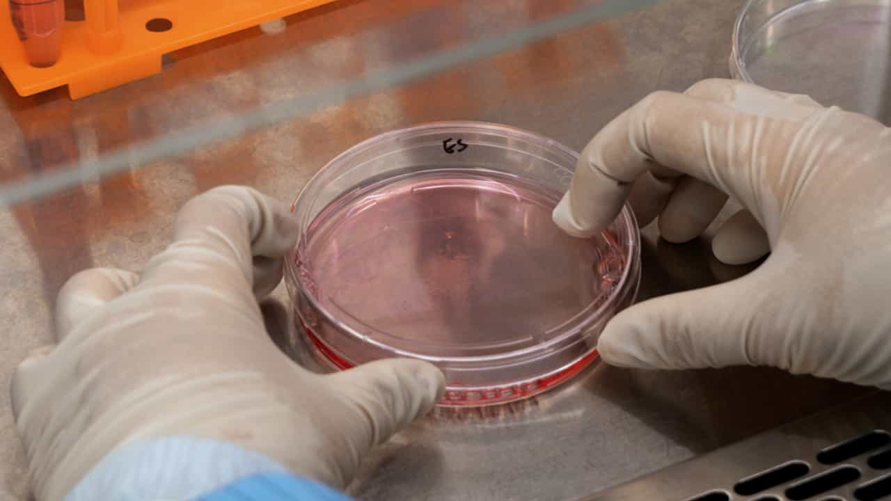Generation of Human Microglia to Combine Them with Retinal Organoids for Improved Disease Modeling