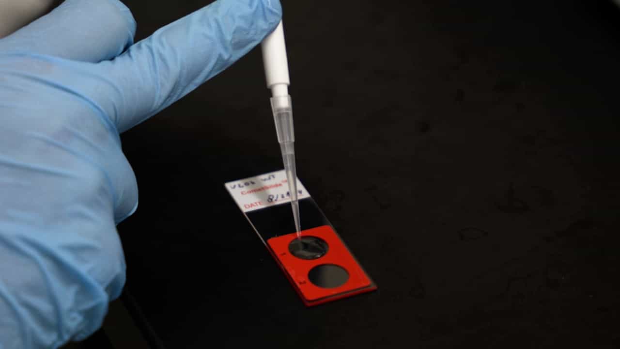 Detection of DNA Breaks in Dividing Human Cells by Neutral Comet Assay