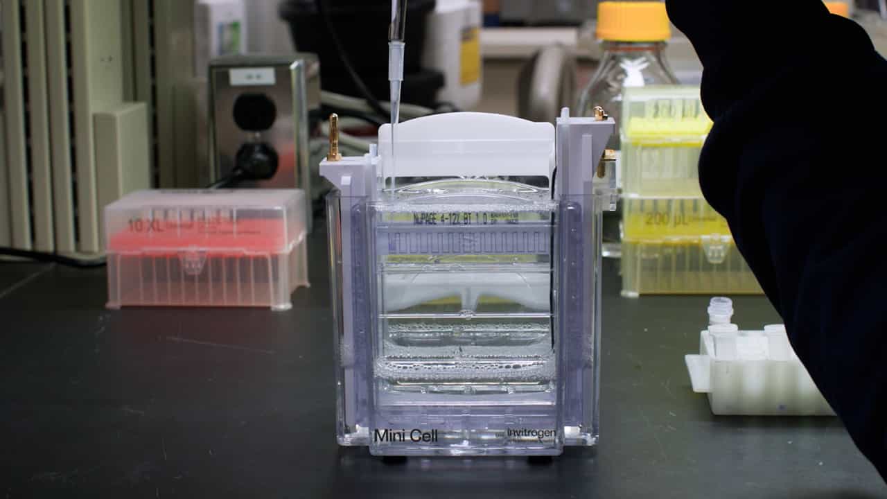 Author Spotlight: Unraveling the Role of Myosin-7a and Usher Proteins in Hearing and Human Disease
