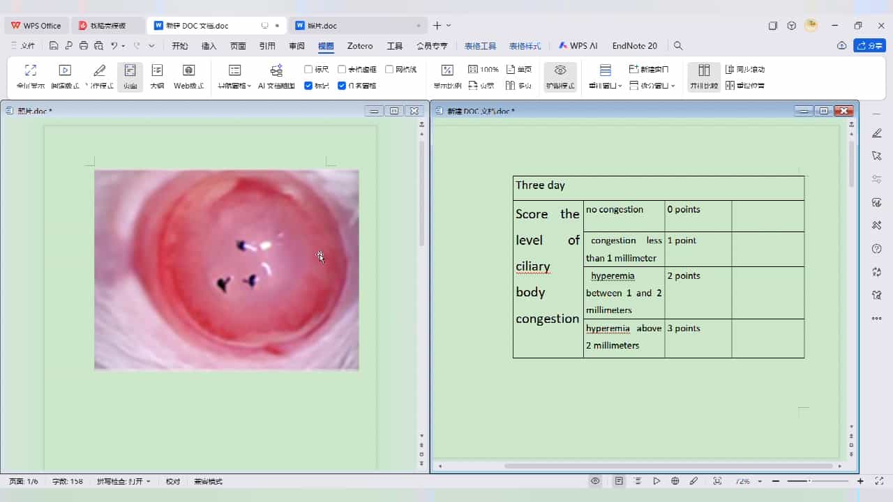 Establishing a Severe Corneal Inflammation Model in Rats Based on Corneal Epithelium Curettage Combined with Corneal Sutures