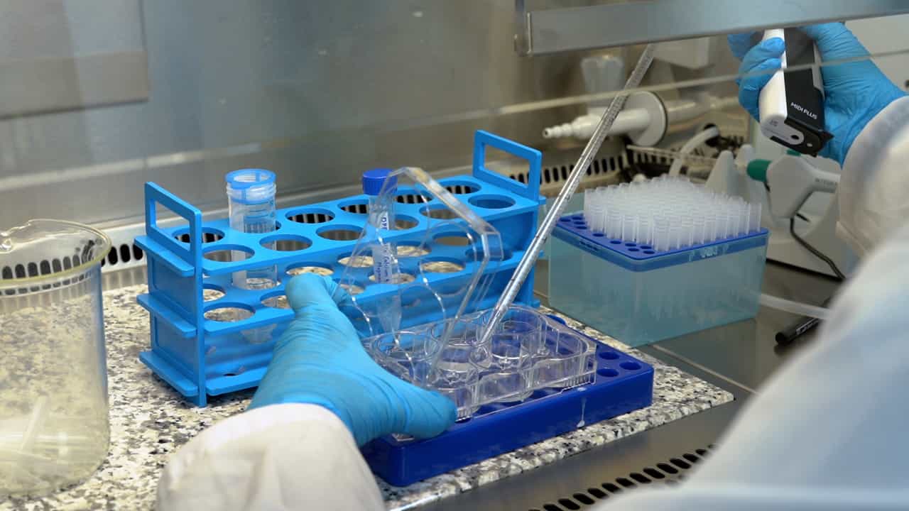 In Vitro Modeling of Down Syndrome Neurogenesis Using Human-Induced Pluripotent Stem Cells