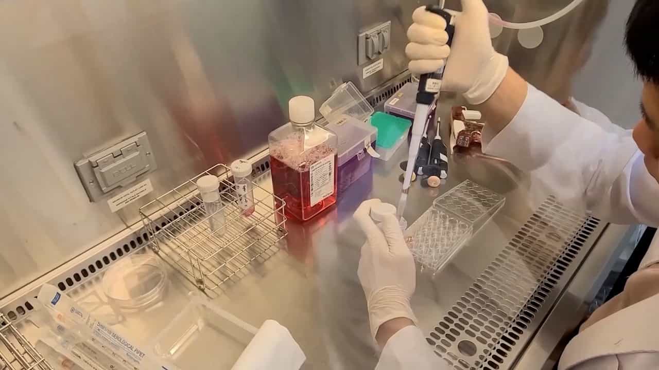 Detection of Anti-MDA5 Autoantibodies Using HeLa Cells and Immunocytochemistry with Light Microscopy
