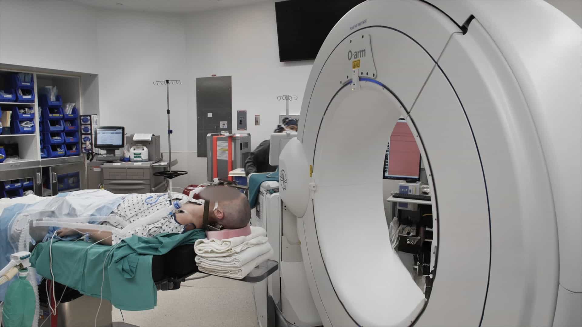 Robotic-Guided Stereoelectroencephalography for Invasive Epilepsy Monitoring