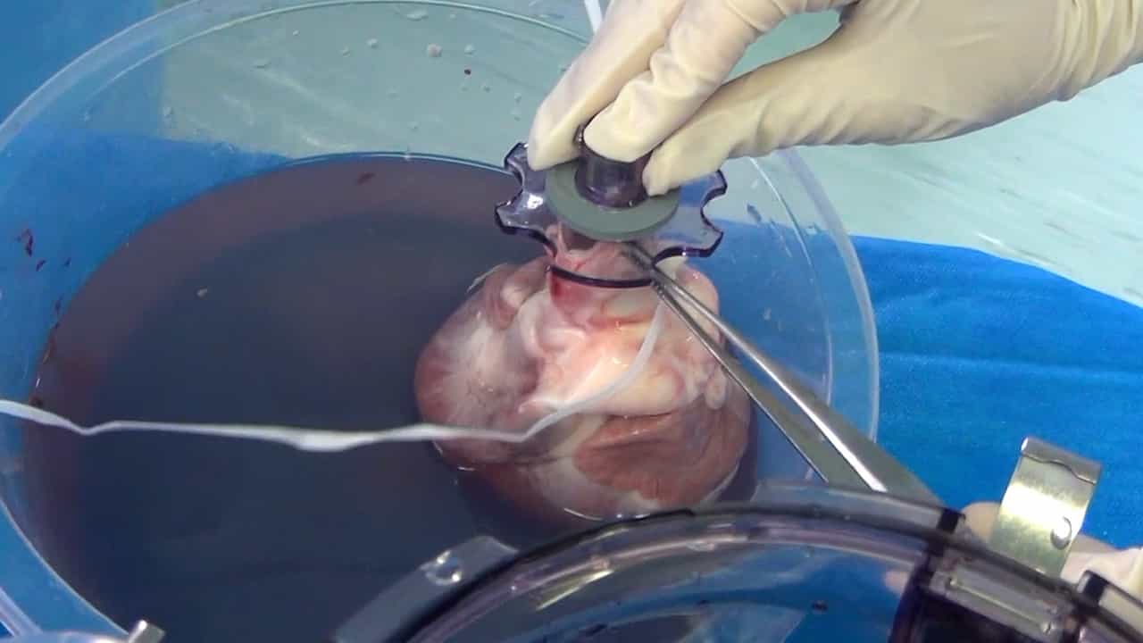 Innovative Strategies for Organ Preservation in Heart Transplantation: Uniform Cooling Preservation and Ex-situ Normothermic Perfusion