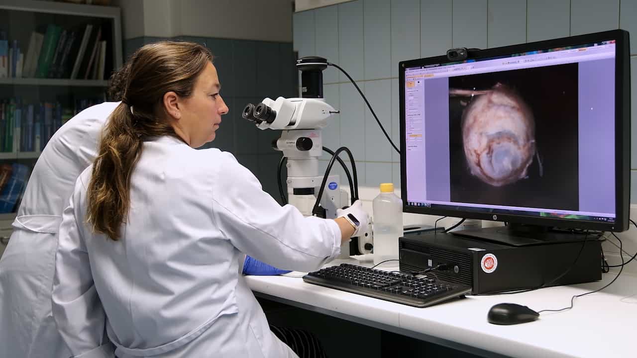 Grossing of Non-neoplastic Globes, Including Fetal Eyes