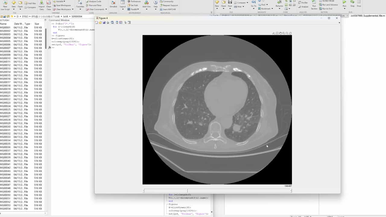 Multifractal Spectrum Analysis for Assessing Pulmonary Nodule Malignancy