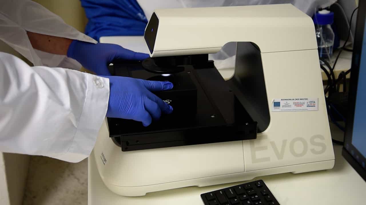 Automated Analysis of C. elegans Fluorescence Images using SegElegans