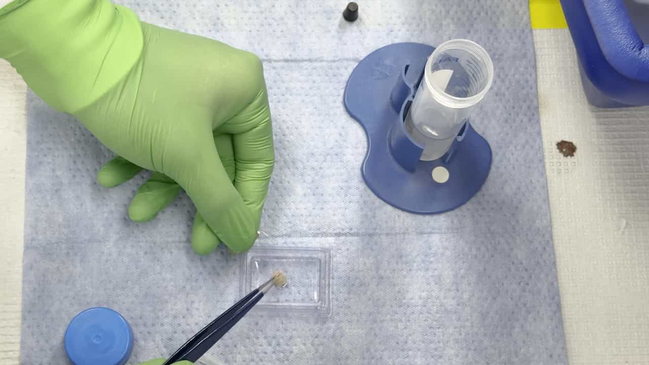 Enhanced Spatial Mapping of Mouse Gastric Muscle Layers Using a Modified Swiss Roll Technique